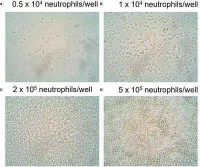 Real-time assessment of neutrophil metabolism and oxidative burst using extracellular flux analysis